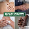 image:imageOKeeffes Skin Repair Ultimate Relief Body Cream 7oz Tube7 Ounce Pack of 1
