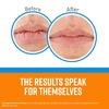 image:imageOKeeffes Lip Repair Lip Balm With Cooling Relief for Dry Cracked Lips  Stick 4 Pack  Moisturizer for Very Dry Lips5  Pack