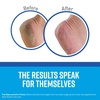 image:imageOKeeffes for Healthy Feet Foot Cream 64 oz Jar NonGreasy3 Ounce Pack of 3