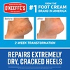 image:imageOKeeffes for Healthy Feet Heel Repair Kit 1 Pair Reusable Sleeves